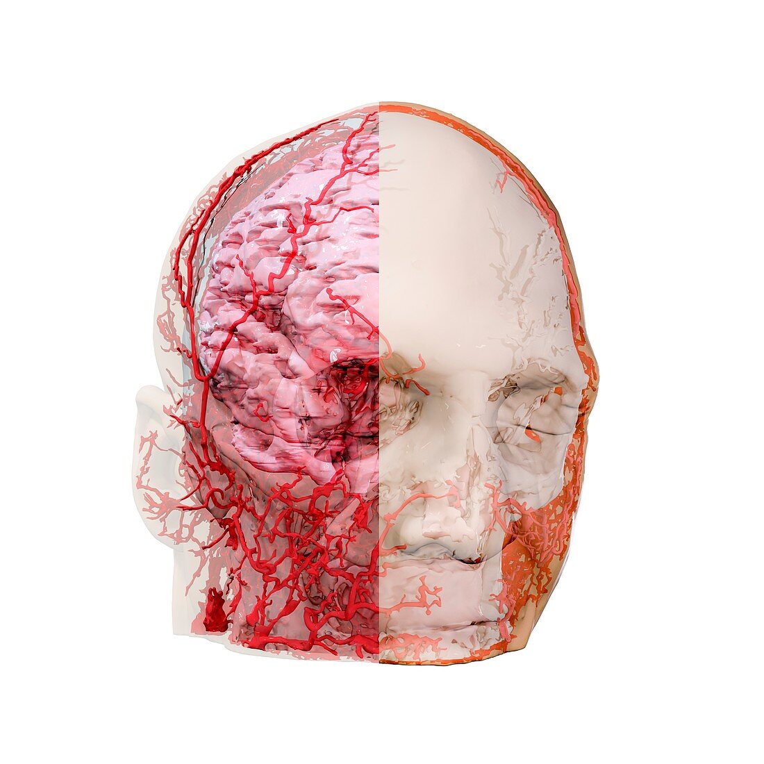 Human head and brain blood vessels, 3D CT scan