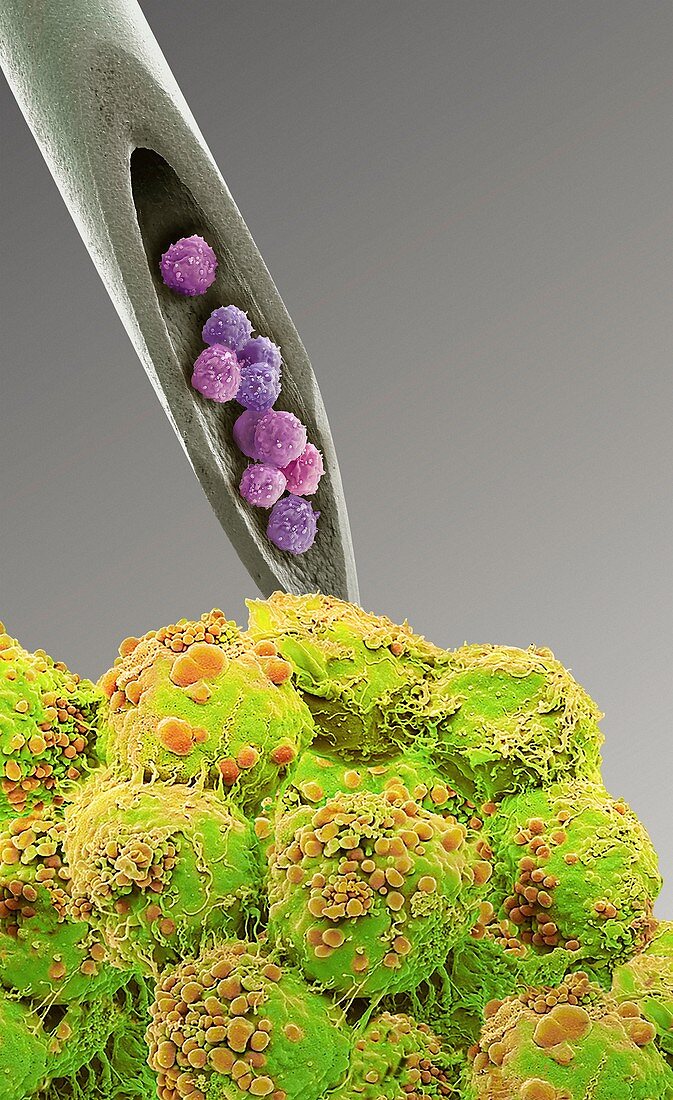Cell therapy, conceptual composite SEM