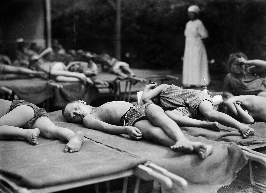 Children with tuberculosis, Austria, 1920