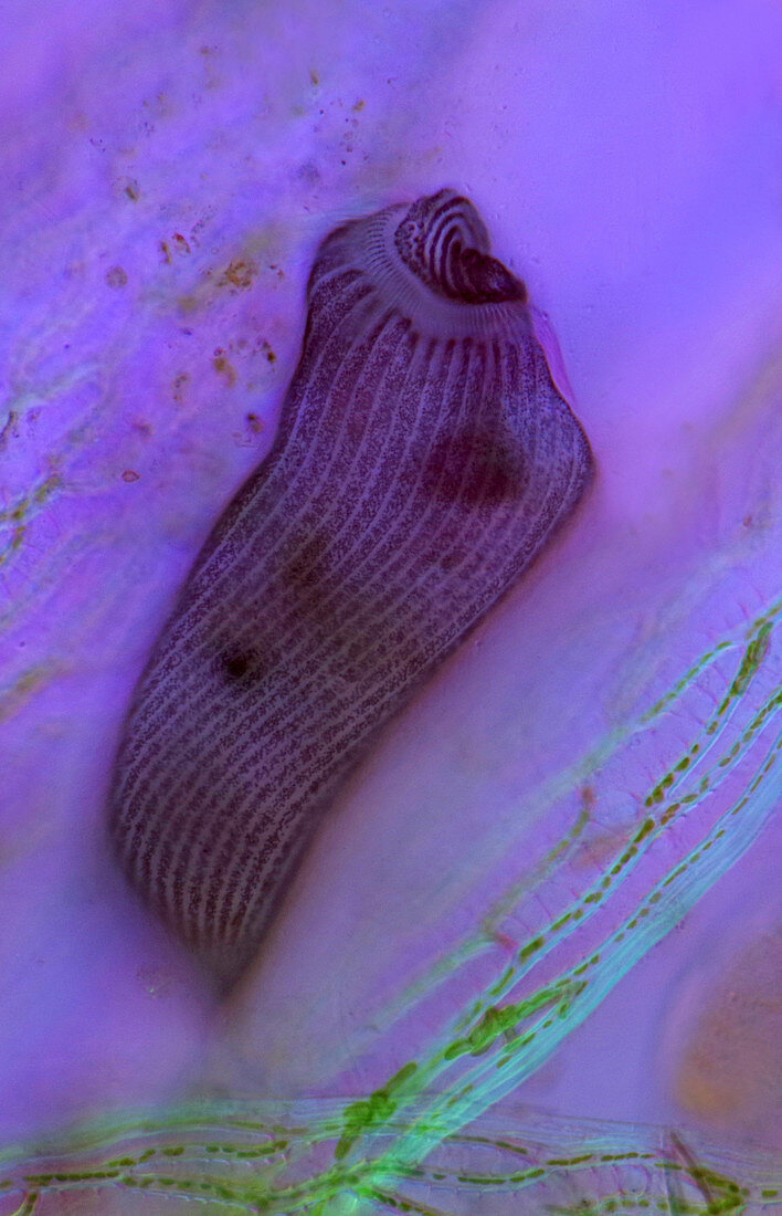 Stentor ciliate protozoan, light micrograph