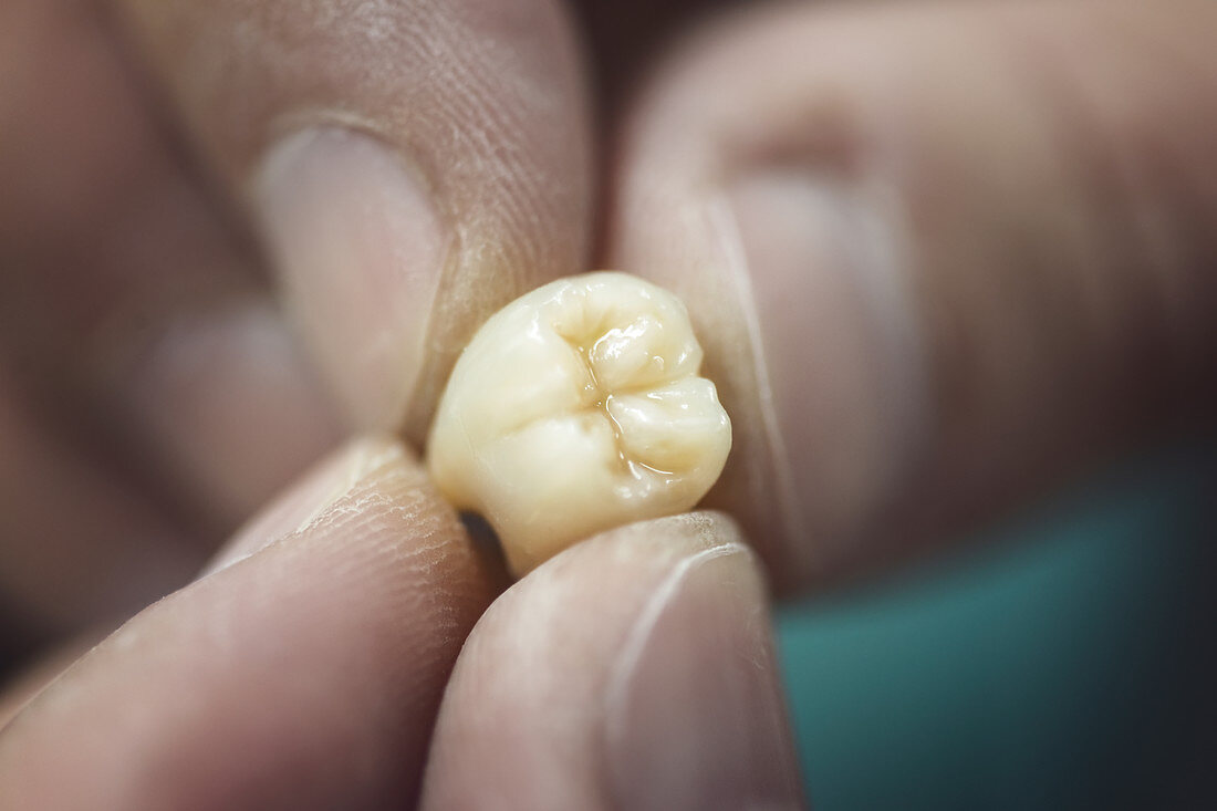 Artificial tooth being made