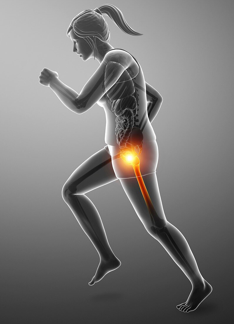 Woman with hip pain, illustration