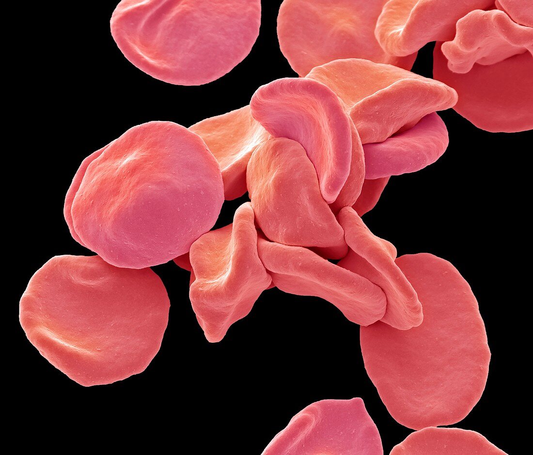 Red blood cells, SEM