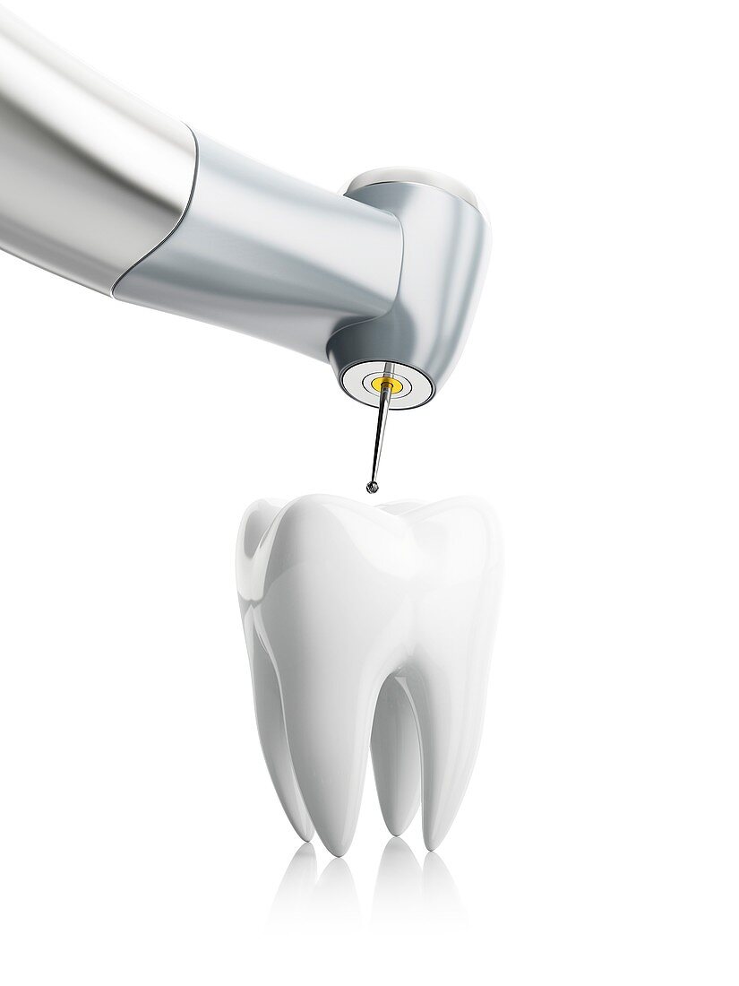 Dental treatment, conceptual illustration