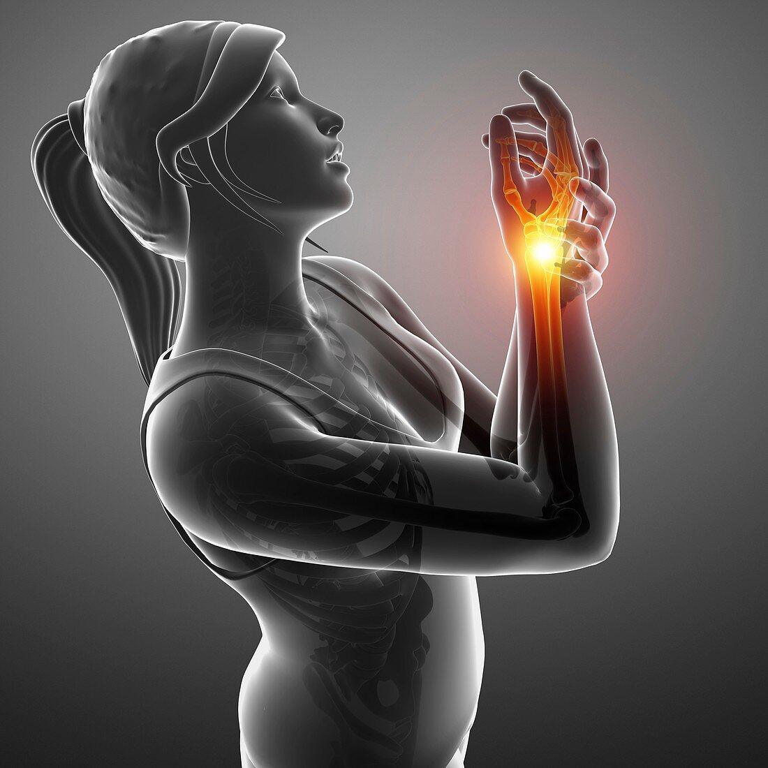 Woman with wrist pain, illustration