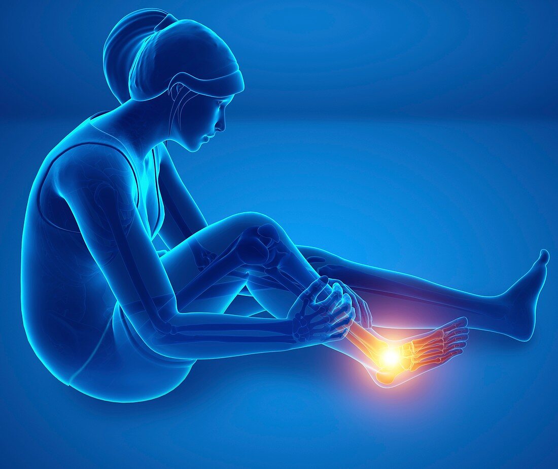 Woman with foot pain, illustration