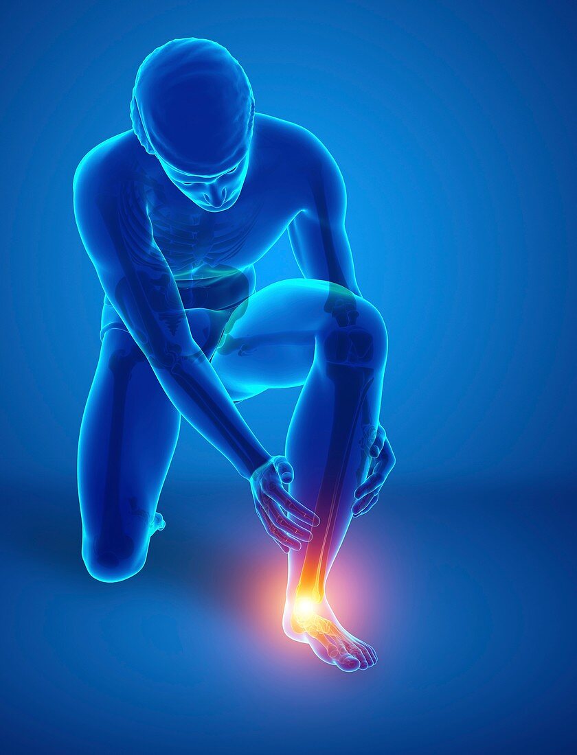 Man with foot pain, illustration