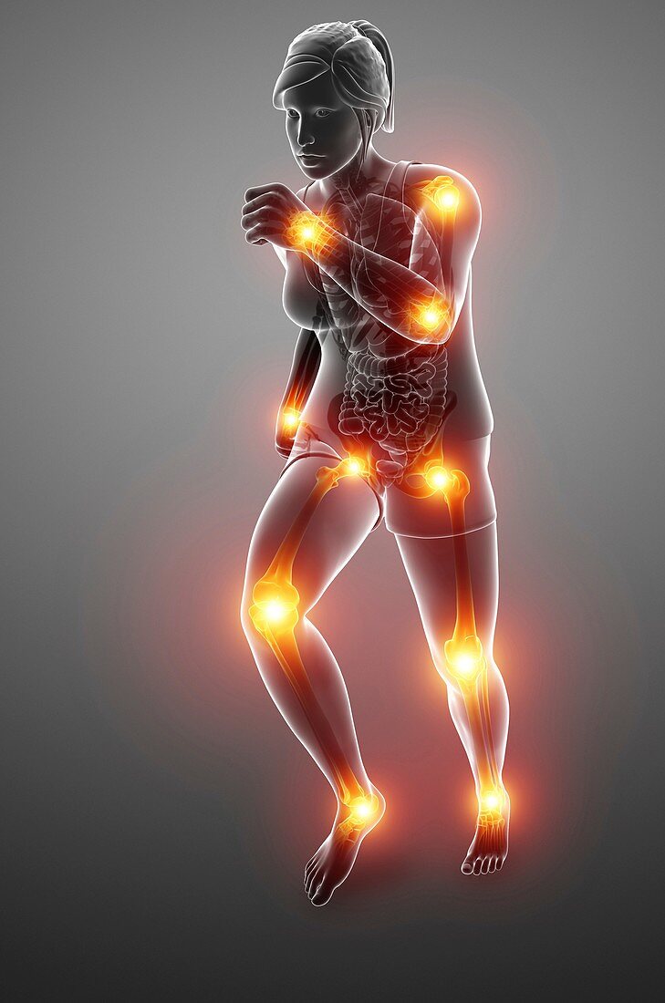 Woman with joint pain, illustration
