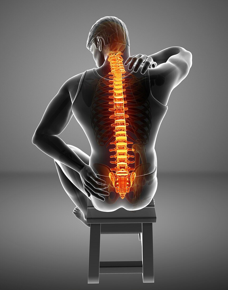 Man with back pain, illustration