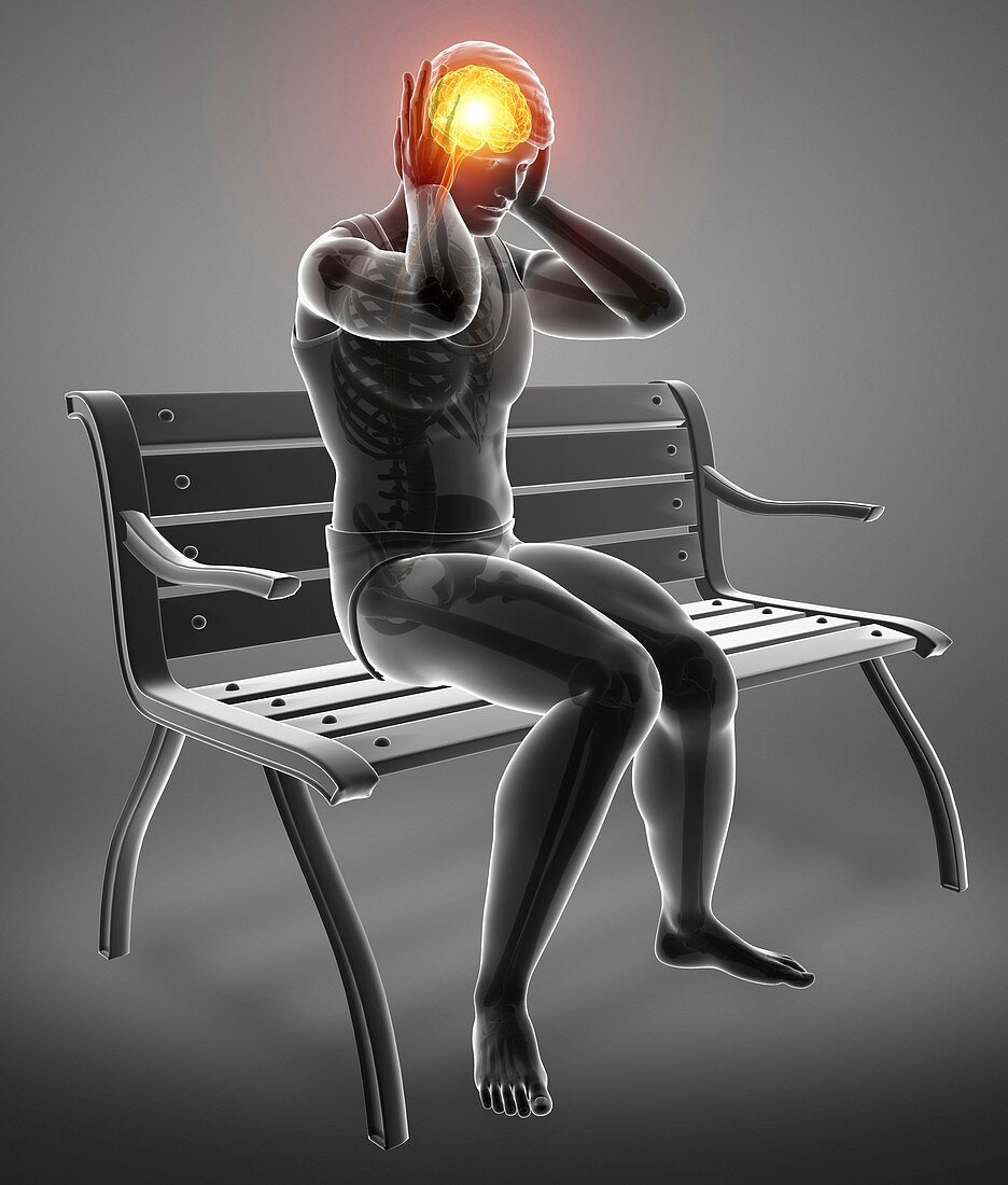 Man with headache, illustration
