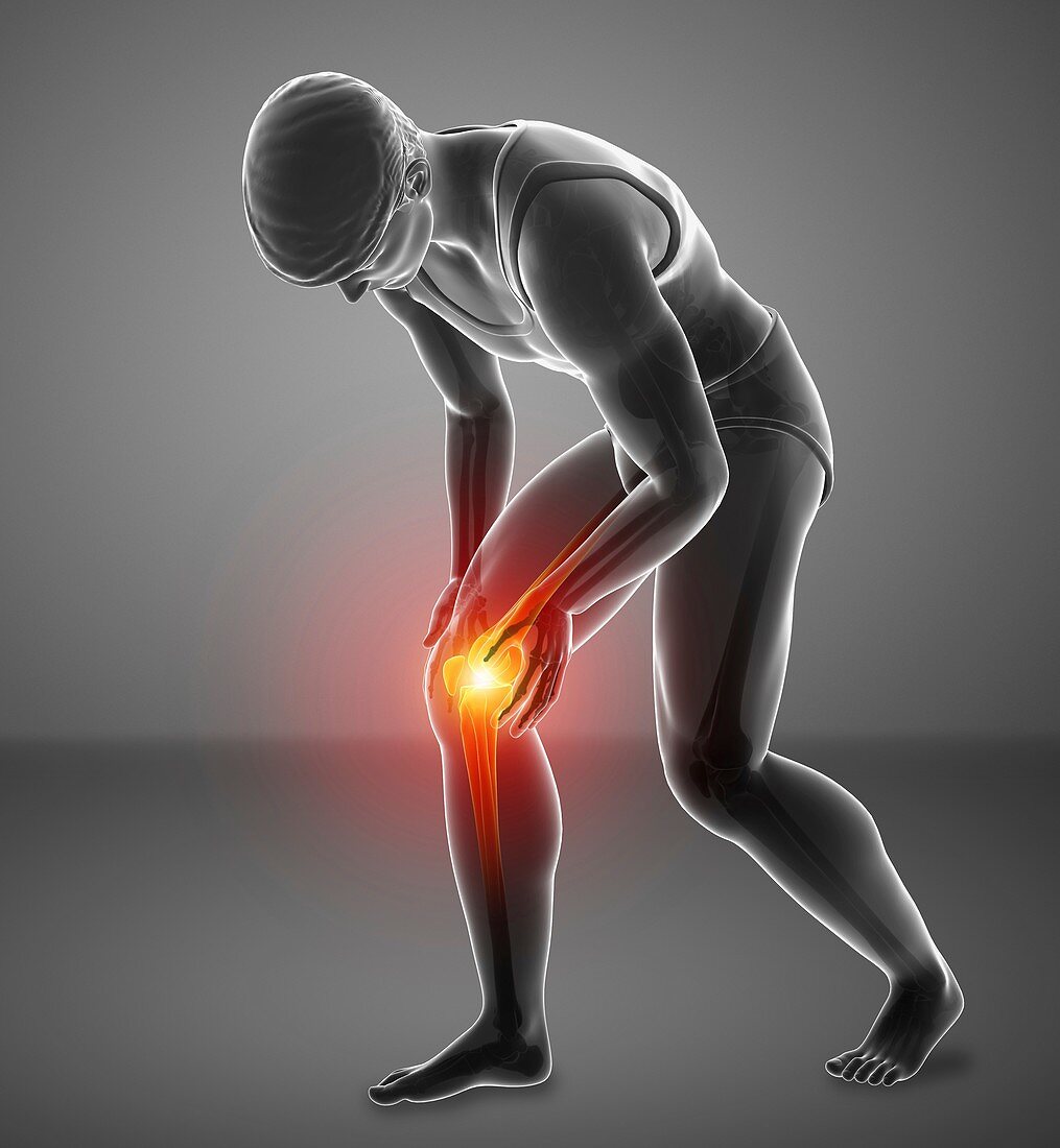 Man with knee pain, illustration