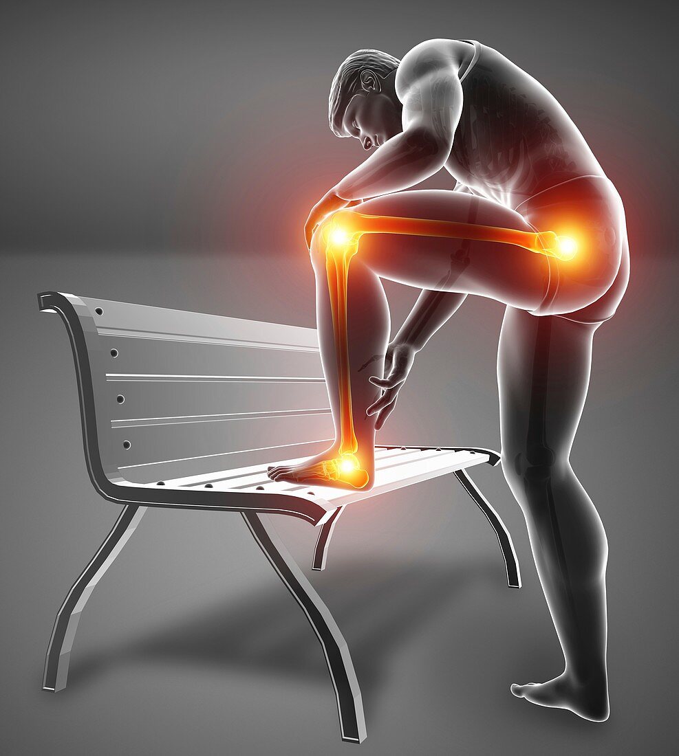 Man with knee pain, illustration