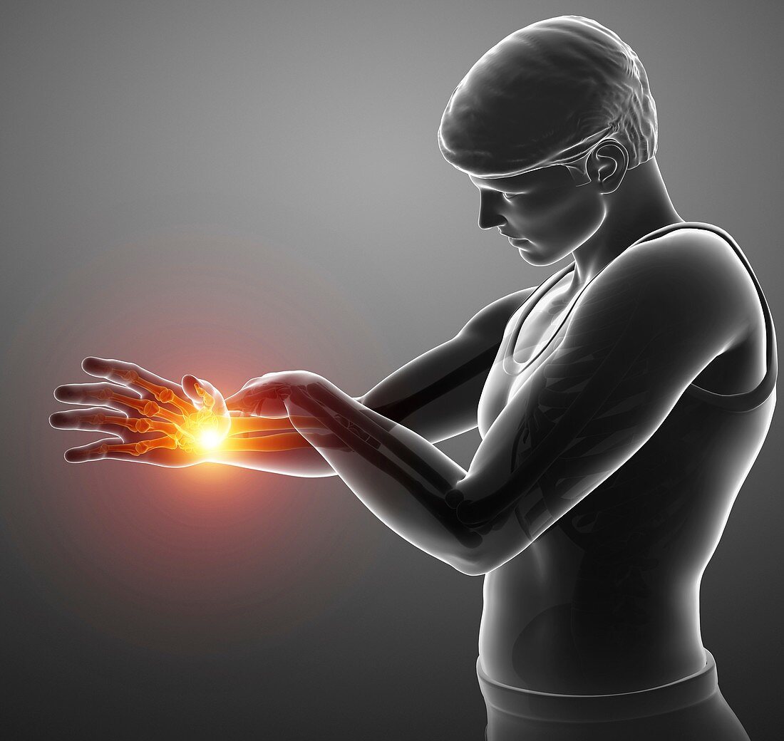 Man with wrist pain, illustration