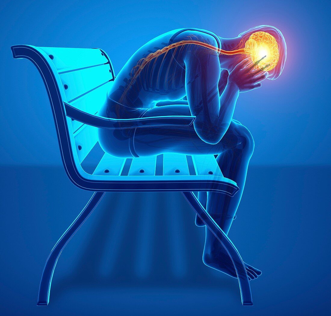 Man with headache, illustration