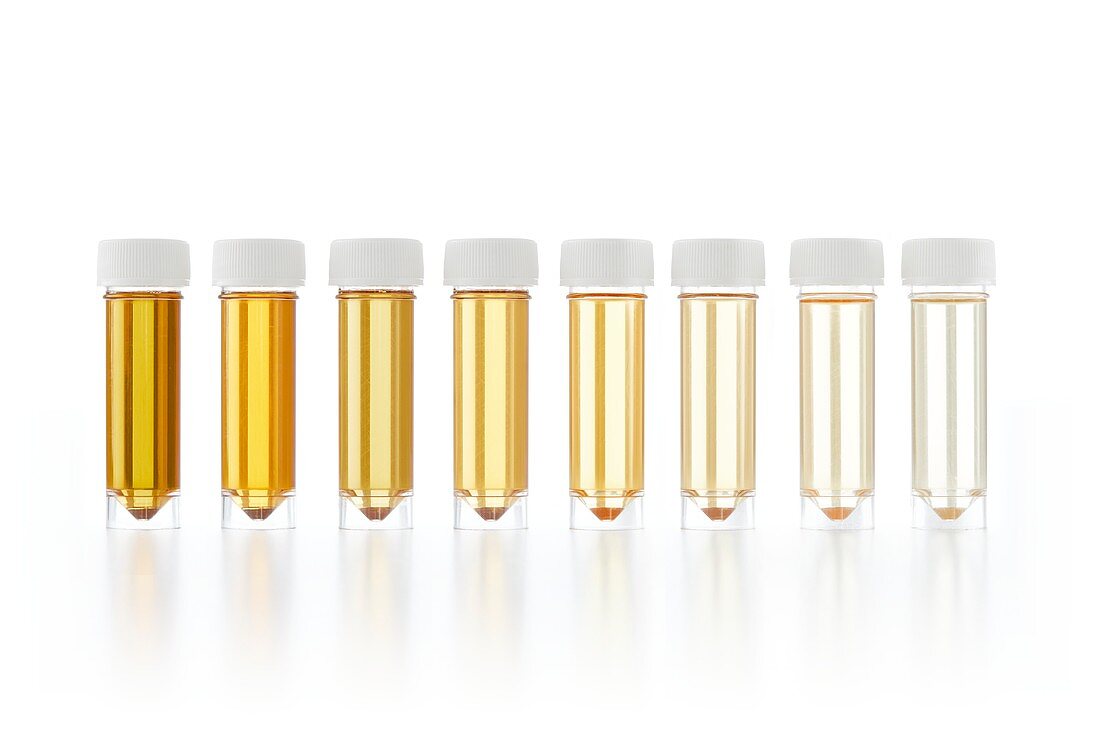 Urine samples for analysis