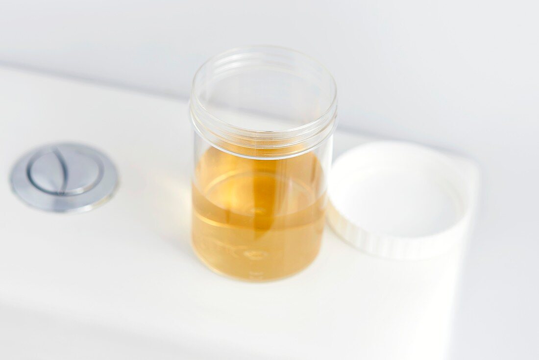 Urine sample on toilet