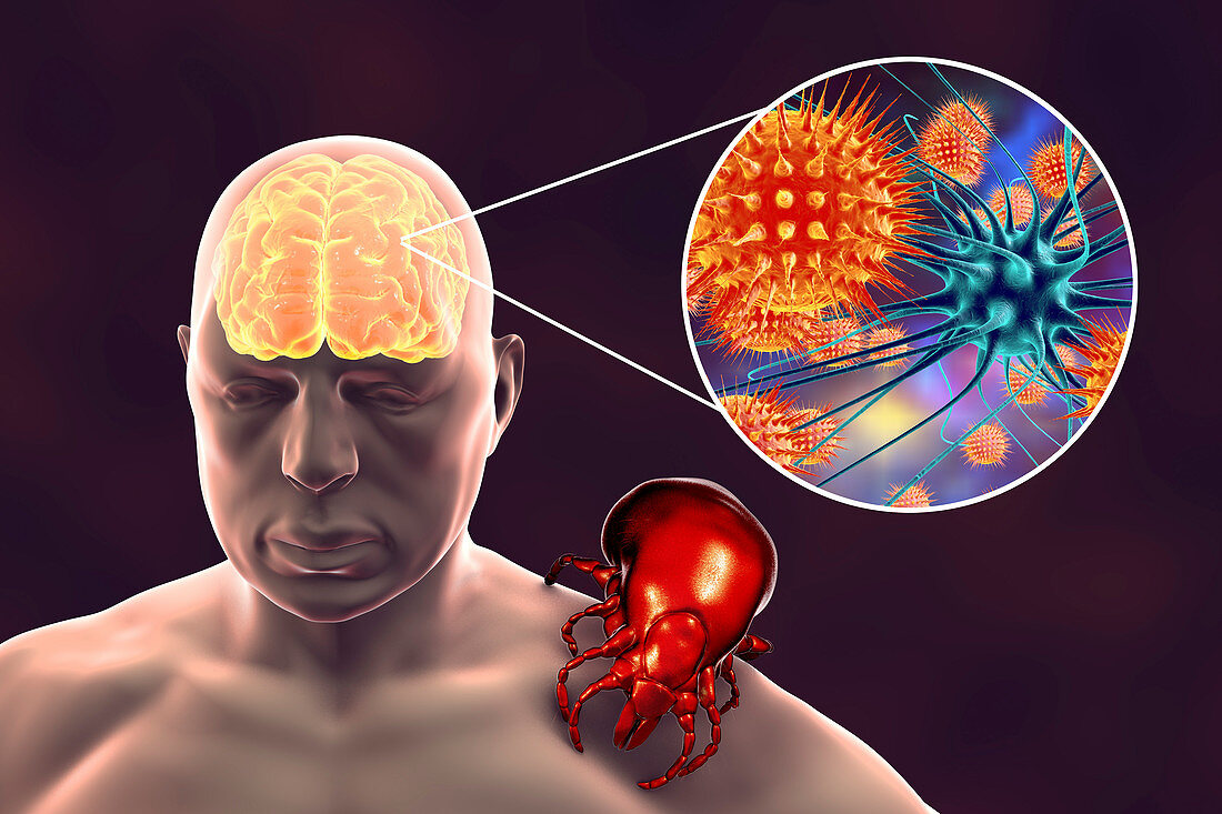 Tick-bourne encephalitis, illustration