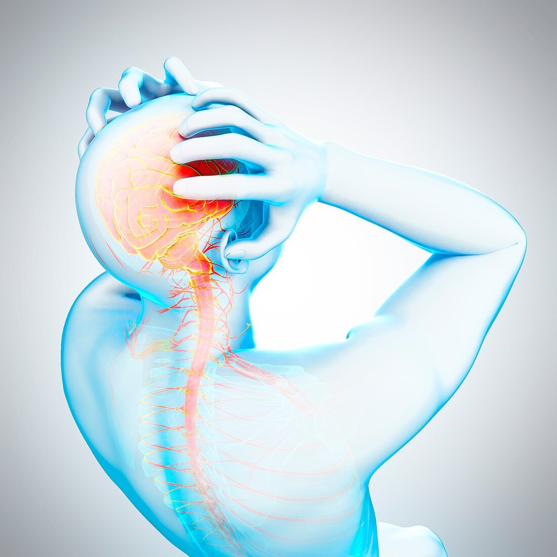 Person with headache, illustration