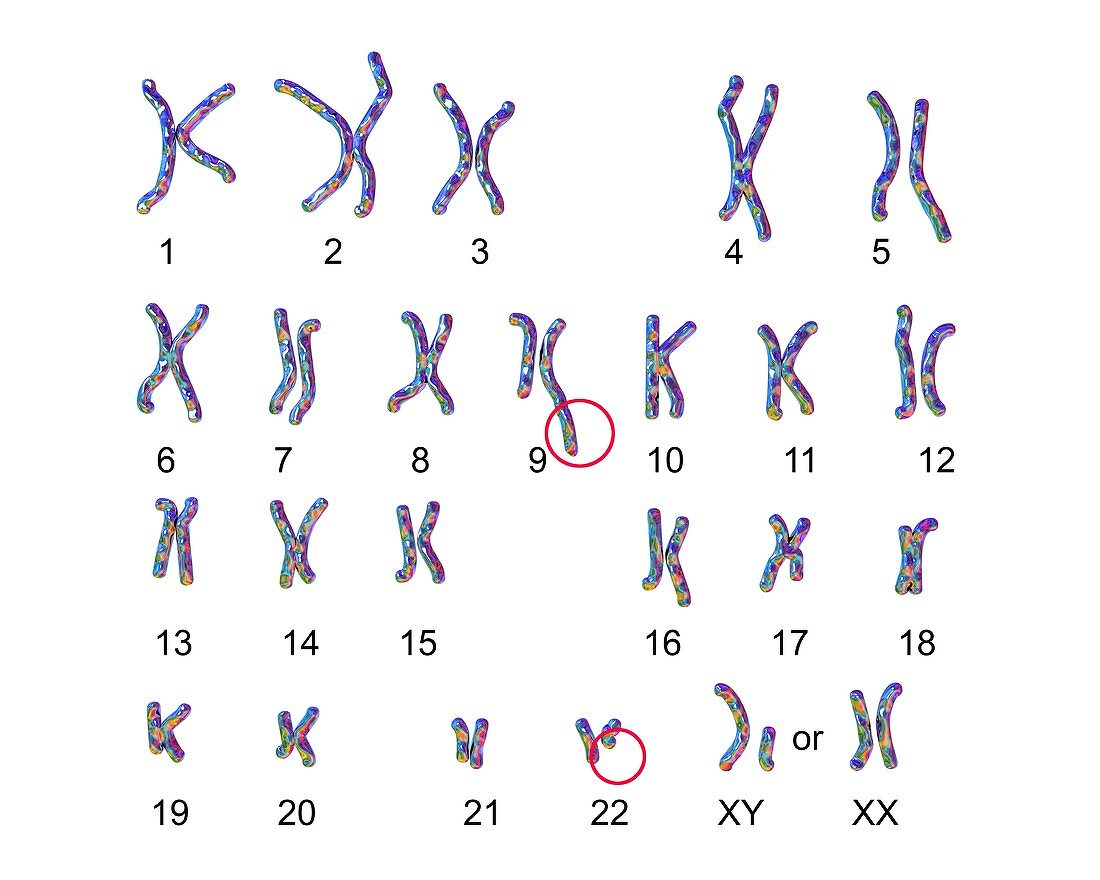 Philadelphia chromosome, illustration