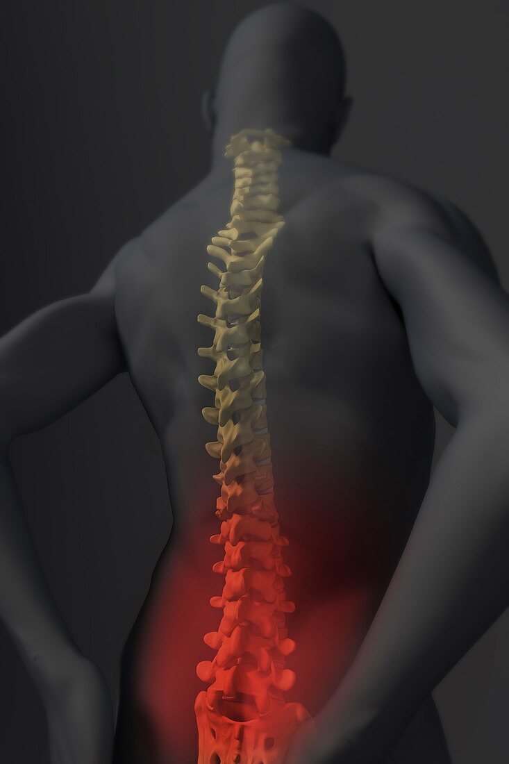 Lower Back Pain, artwork
