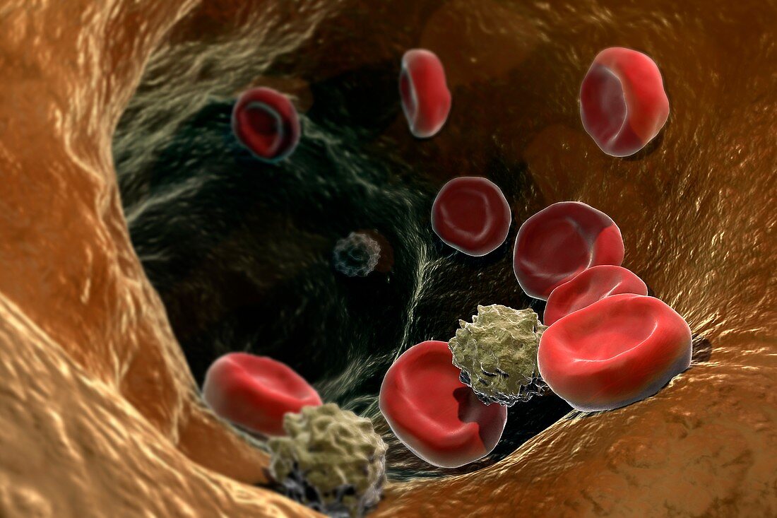 Blood Cells, artwork