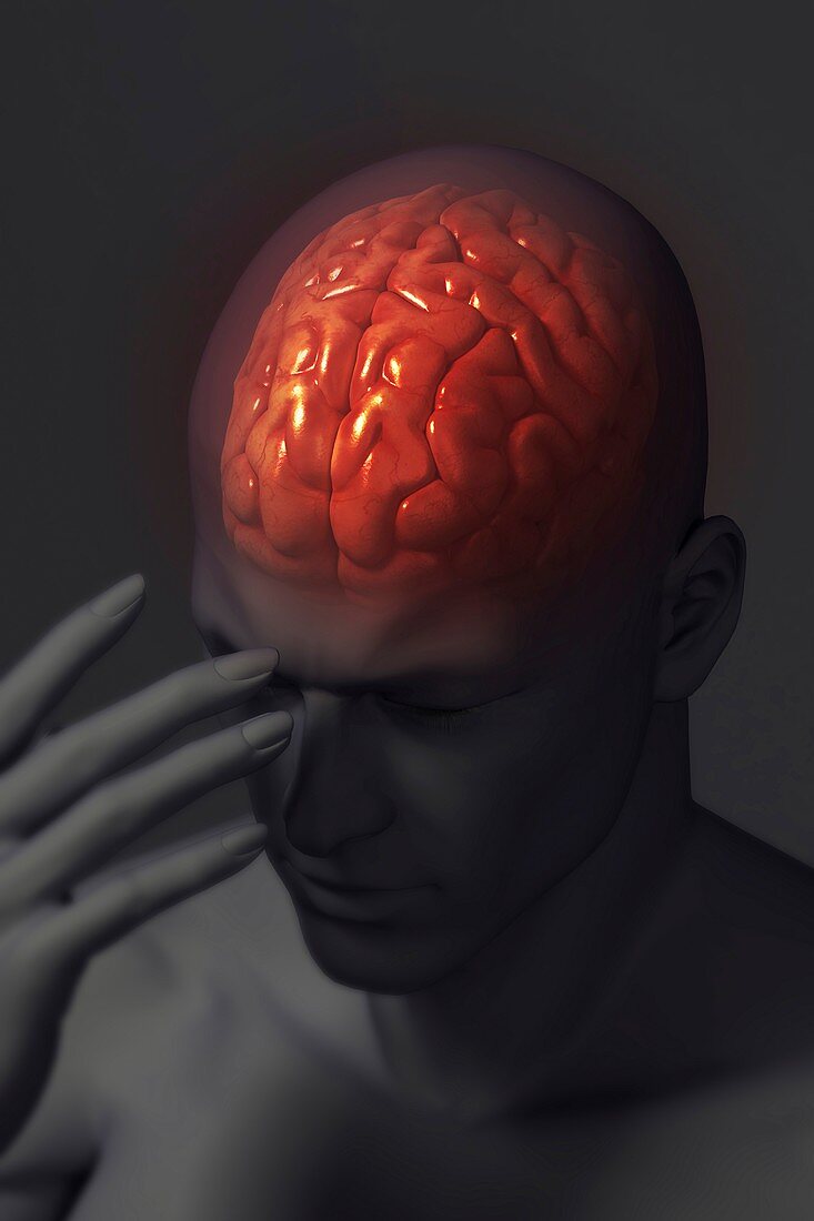 Head Pain, artwork