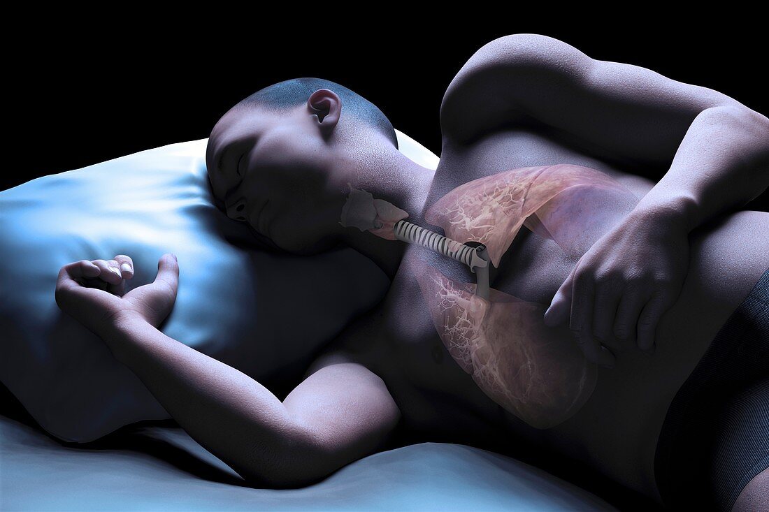 Sleep Apnoea, artwork