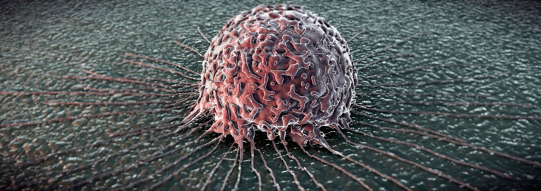 Breast Cancer Cell, artwork