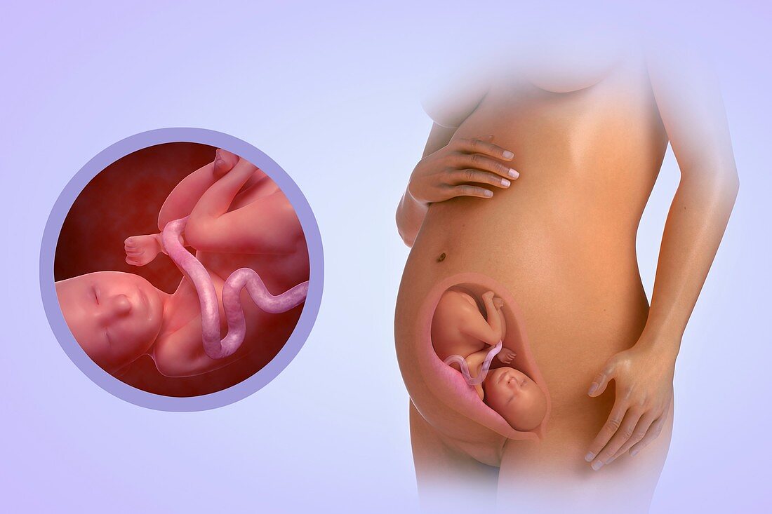 Fetal Development (Week 27), artwork