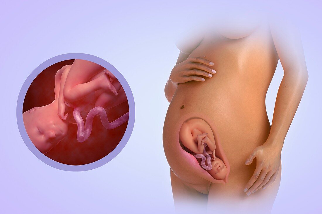 Fetal Development (Week 29), artwork