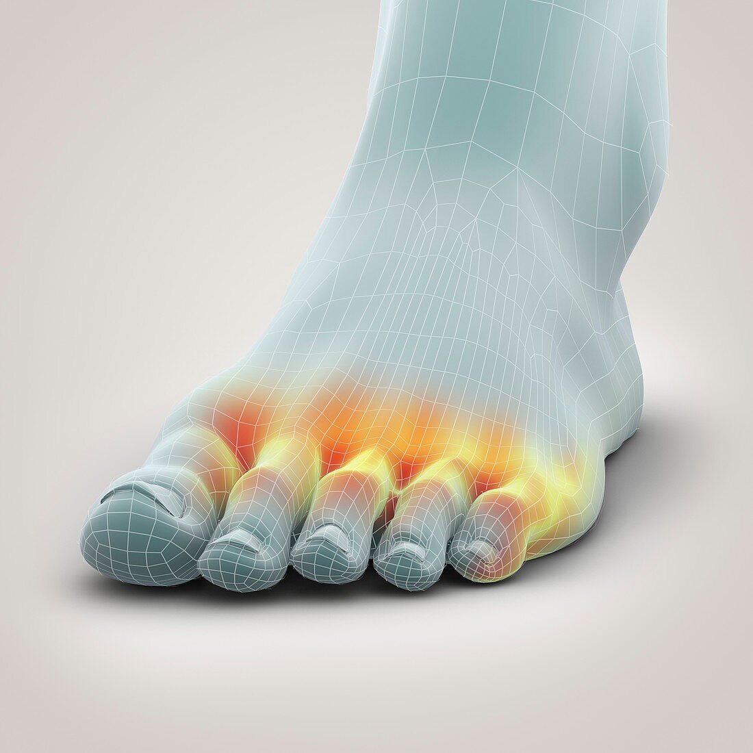 Athlete's Foot, artwork