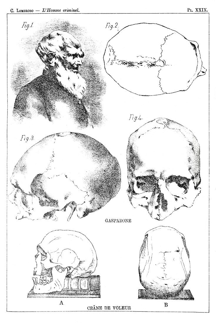 Skulls of criminals, 19th century