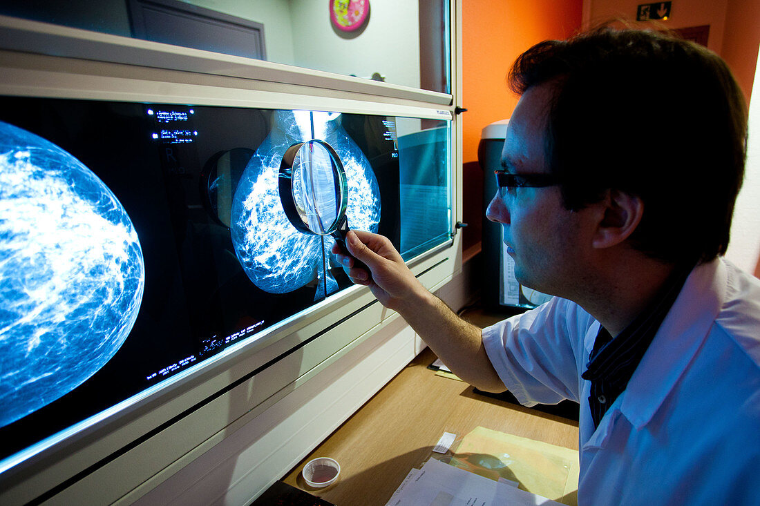 Digital mammography