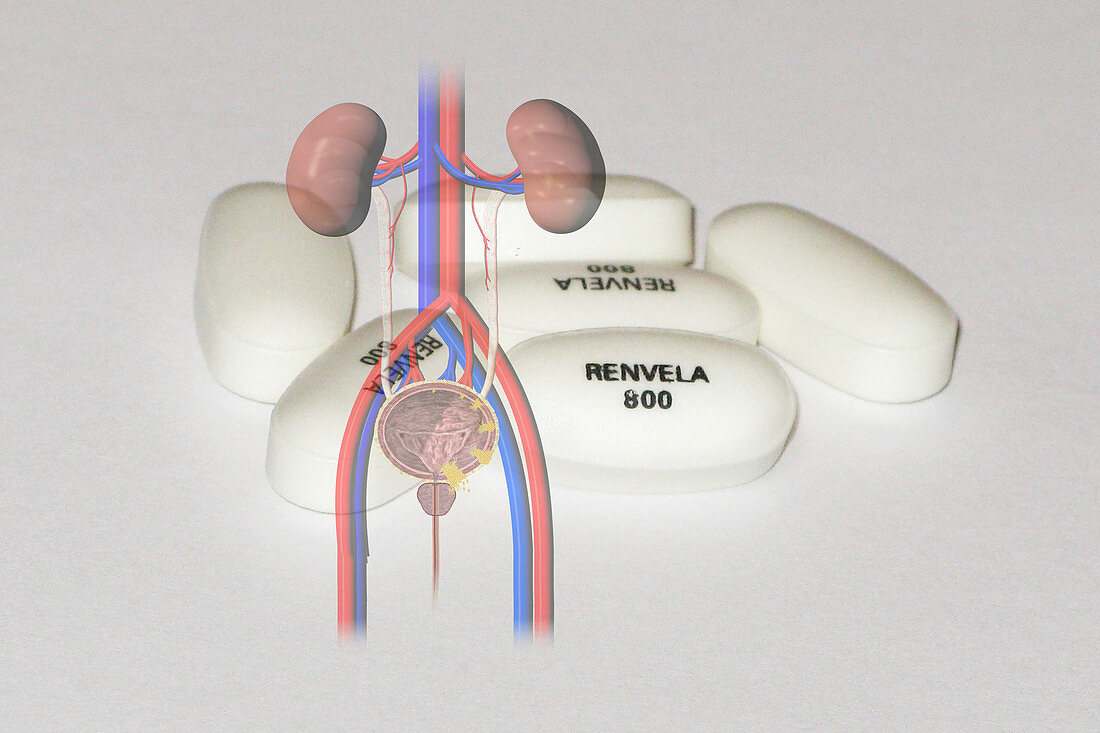 Renvela kidney disease drug, composite image