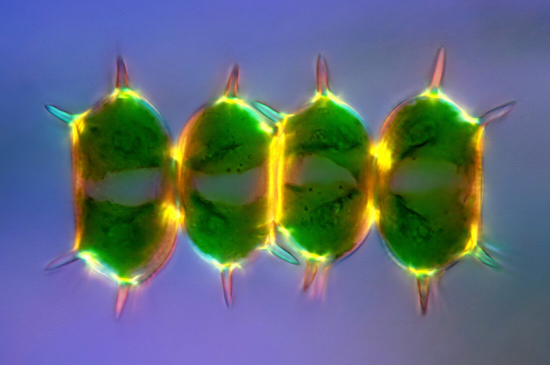 Xanthidium desmids, light micrograph
