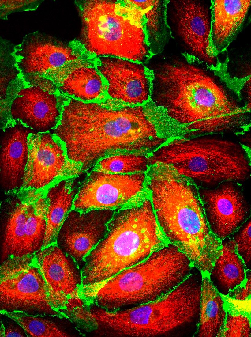 Breast epithelial cells, fluorescence light micrograph