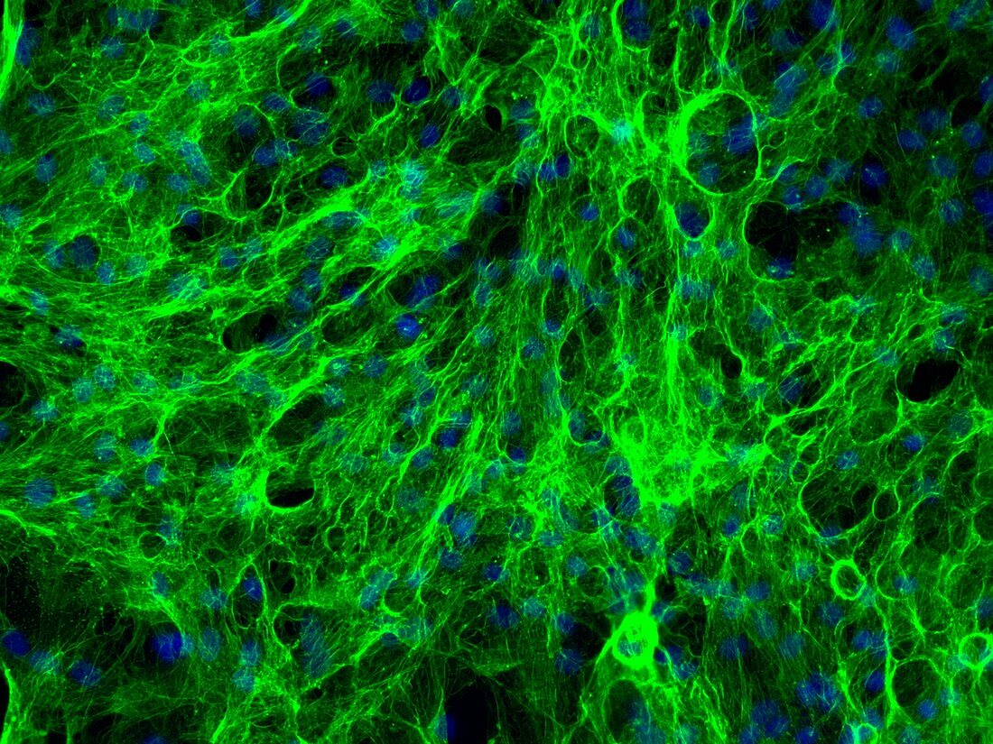 Perineurial fibroblast cells, fluorescence light micrograph