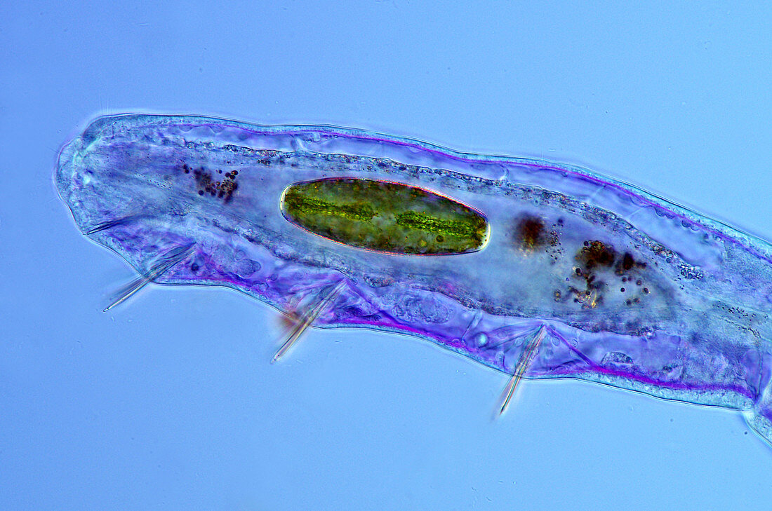 Desmid eaten by annelid worm, light micrograph