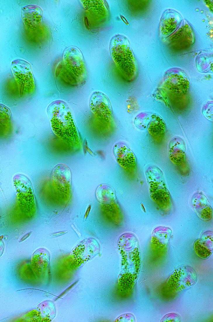 Ophrydium protozoa, light micrograph