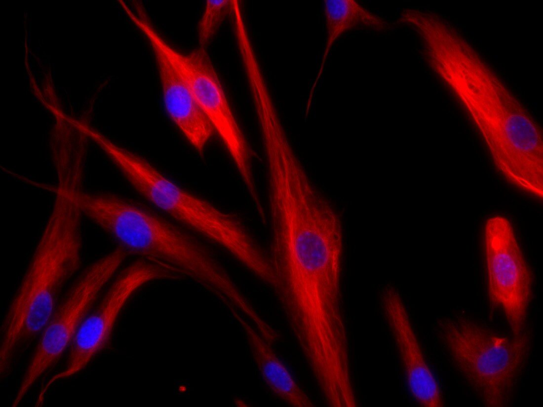 Dermal fibroblast cells, fluorescence light micrograph