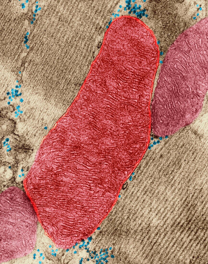 Mitochondrion from a heart muscle cell, TEM