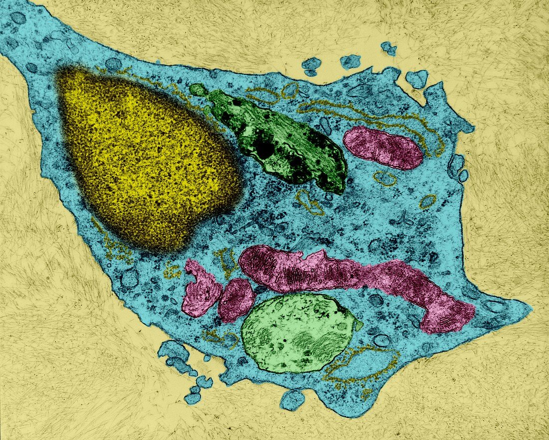 Neuroglia cell destroying beta-amyloid, TEM