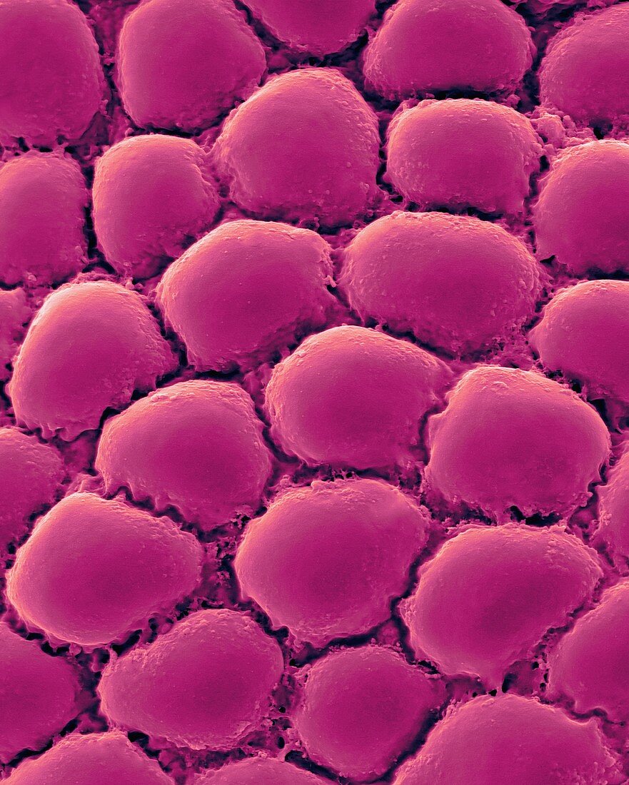 Fat cells from adipose tissue, SEM