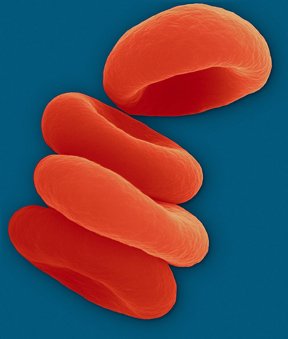 Red blood cells in the Rouleau formation, SEM