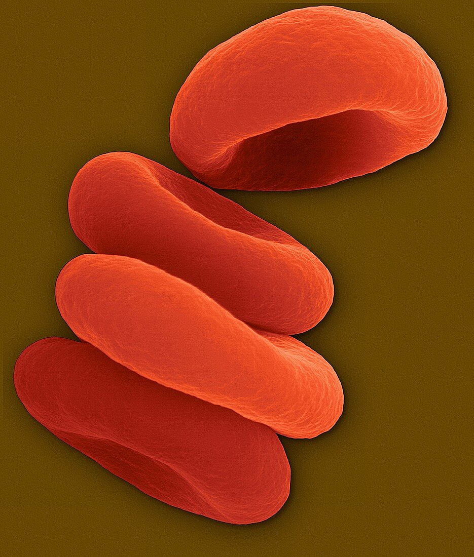 Red blood cells in the Rouleau formation, SEM