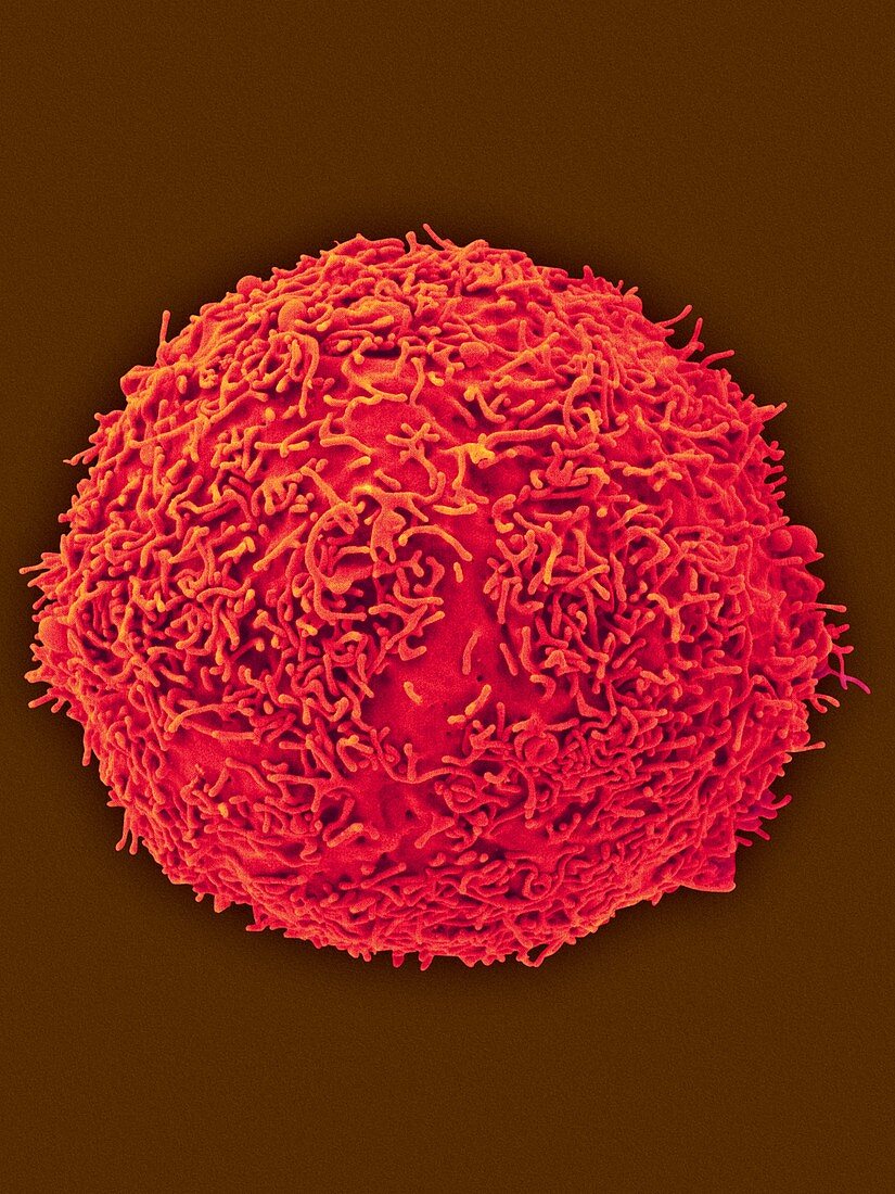 Human lymphoblast, SEM