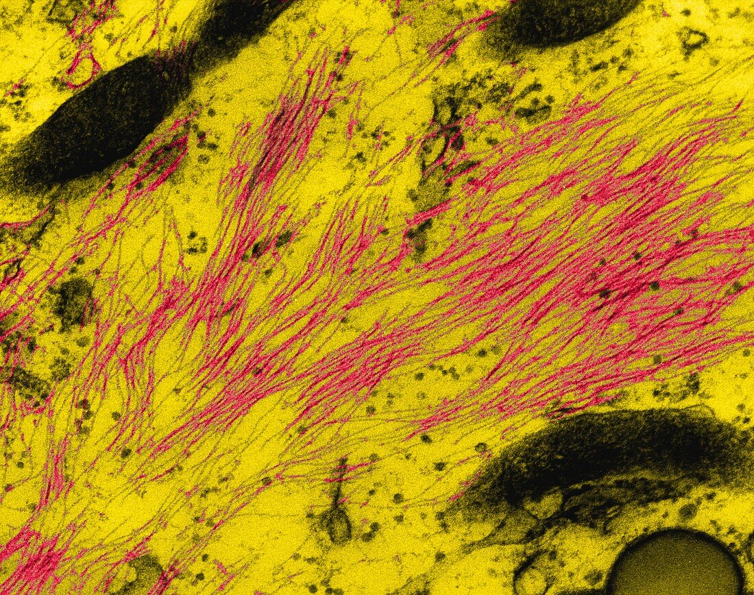 Neurofilaments in a glial cell, TEM