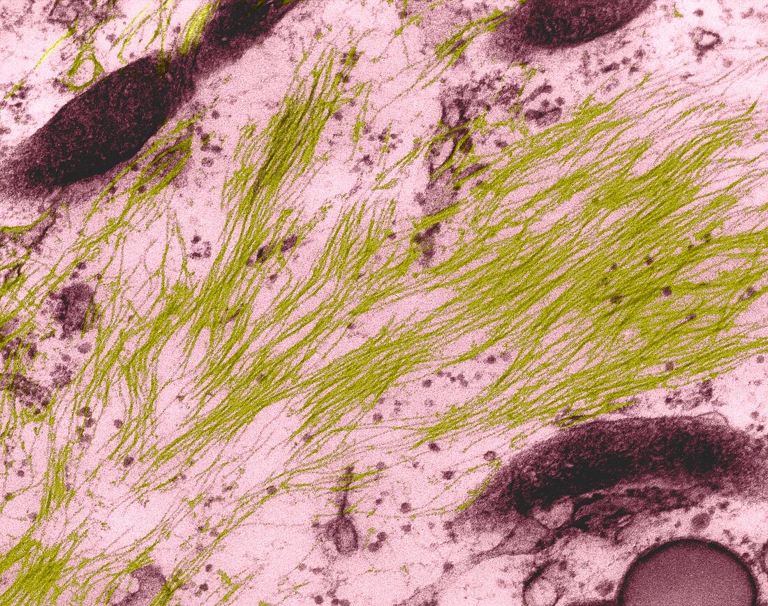 Neurofilaments in a glial cell, TEM