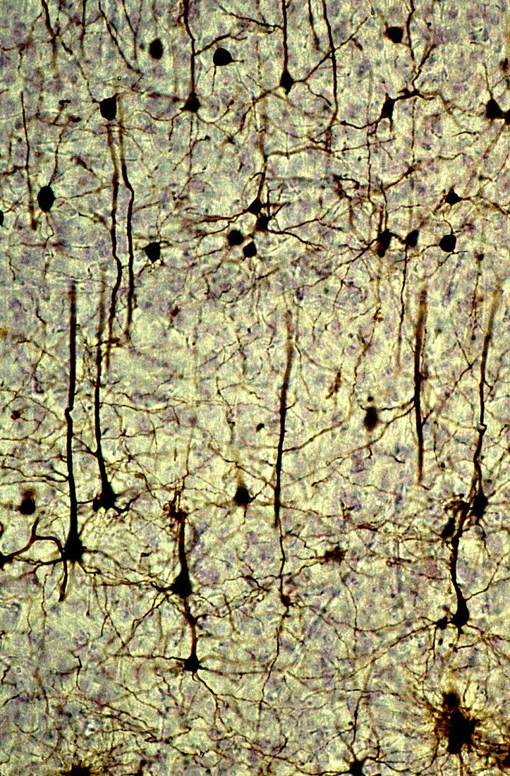 Cerebral cortex pyramidal neurons, LM Brightfield