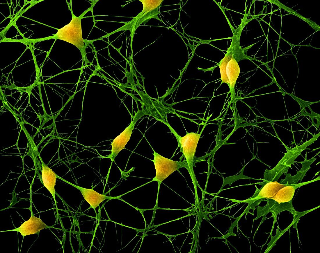 Cortical neurons, SEM